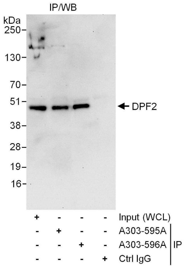 DPF2 Antibody in Immunoprecipitation (IP)