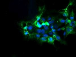 DPH2 Antibody in Immunocytochemistry (ICC/IF)