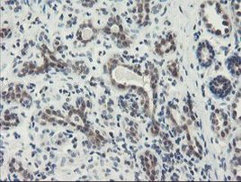 DPH2 Antibody in Immunohistochemistry (Paraffin) (IHC (P))