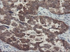 DPH2 Antibody in Immunohistochemistry (Paraffin) (IHC (P))