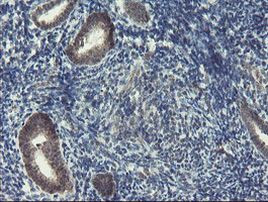 DPH2 Antibody in Immunohistochemistry (Paraffin) (IHC (P))