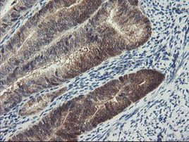 DPH2 Antibody in Immunohistochemistry (Paraffin) (IHC (P))