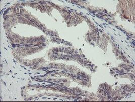 DPH2 Antibody in Immunohistochemistry (Paraffin) (IHC (P))