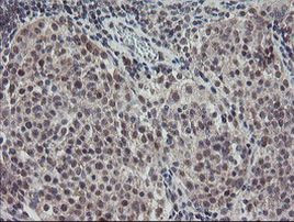 DPH2 Antibody in Immunohistochemistry (Paraffin) (IHC (P))