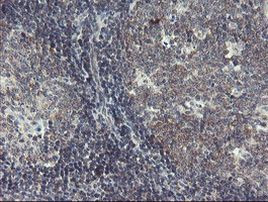 DPH2 Antibody in Immunohistochemistry (Paraffin) (IHC (P))