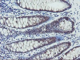 DPH2 Antibody in Immunohistochemistry (Paraffin) (IHC (P))