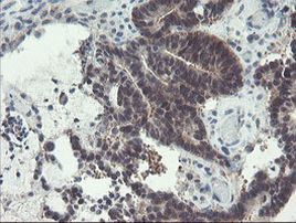 DPH2 Antibody in Immunohistochemistry (Paraffin) (IHC (P))