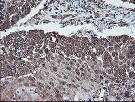 DPH2 Antibody in Immunohistochemistry (Paraffin) (IHC (P))