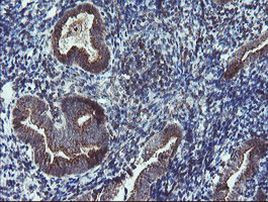 DPH2 Antibody in Immunohistochemistry (Paraffin) (IHC (P))