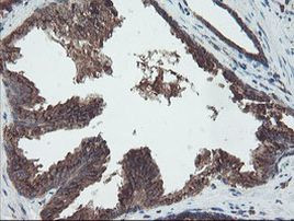 DPH2 Antibody in Immunohistochemistry (Paraffin) (IHC (P))