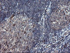 DPH2 Antibody in Immunohistochemistry (Paraffin) (IHC (P))