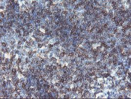 DPH2 Antibody in Immunohistochemistry (Paraffin) (IHC (P))