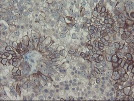 DPH2 Antibody in Immunohistochemistry (Paraffin) (IHC (P))