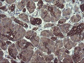 DPH2 Antibody in Immunohistochemistry (Paraffin) (IHC (P))