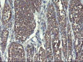 DPH2 Antibody in Immunohistochemistry (Paraffin) (IHC (P))