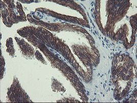 DPH2 Antibody in Immunohistochemistry (Paraffin) (IHC (P))