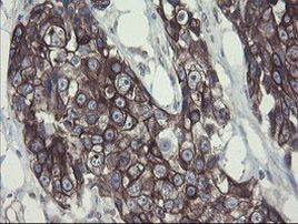 DPH2 Antibody in Immunohistochemistry (Paraffin) (IHC (P))