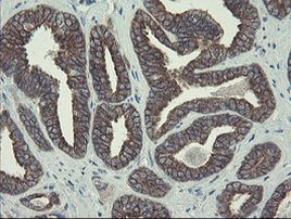 DPH2 Antibody in Immunohistochemistry (Paraffin) (IHC (P))