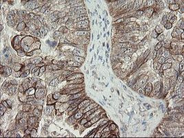 DPH2 Antibody in Immunohistochemistry (Paraffin) (IHC (P))