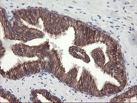 DPH2 Antibody in Immunohistochemistry (Paraffin) (IHC (P))