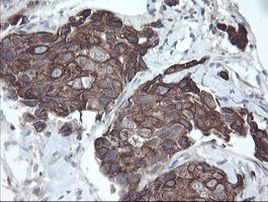 DPH2 Antibody in Immunohistochemistry (Paraffin) (IHC (P))