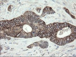 DPH2 Antibody in Immunohistochemistry (Paraffin) (IHC (P))