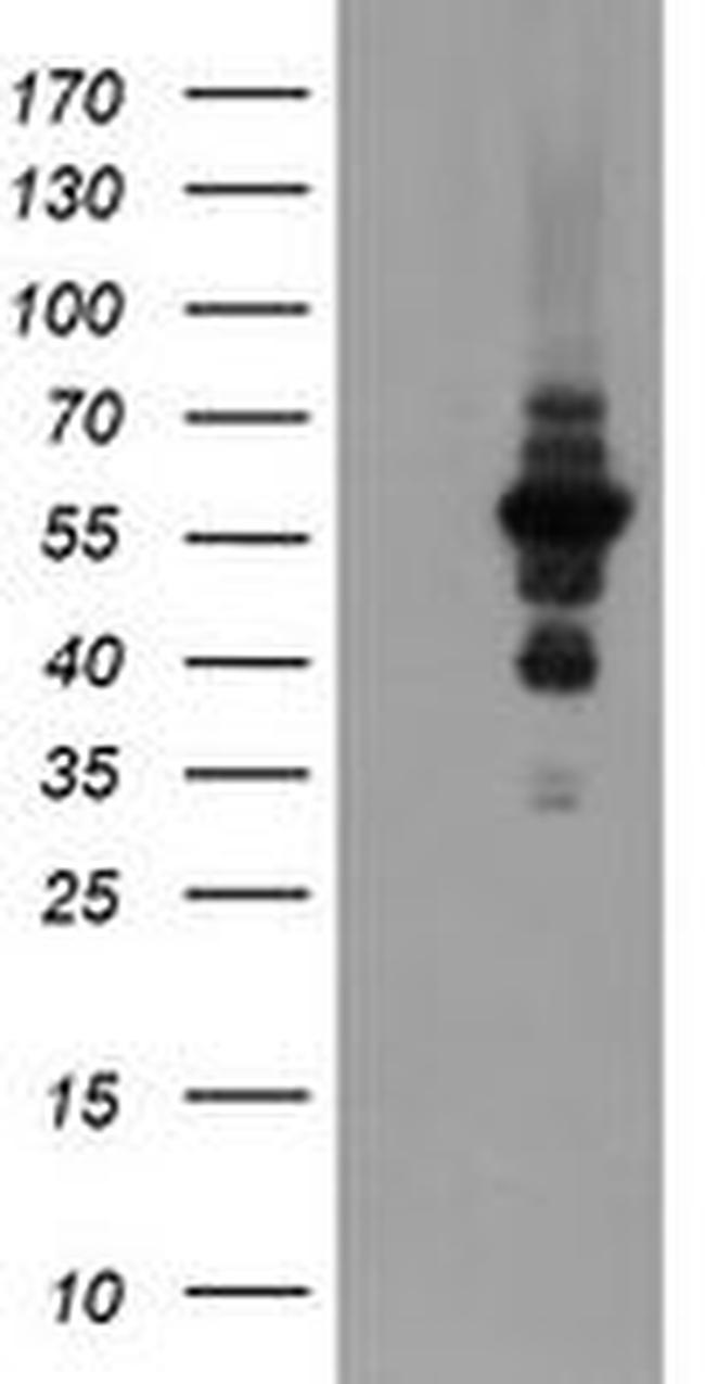 DPH2 Antibody in Western Blot (WB)