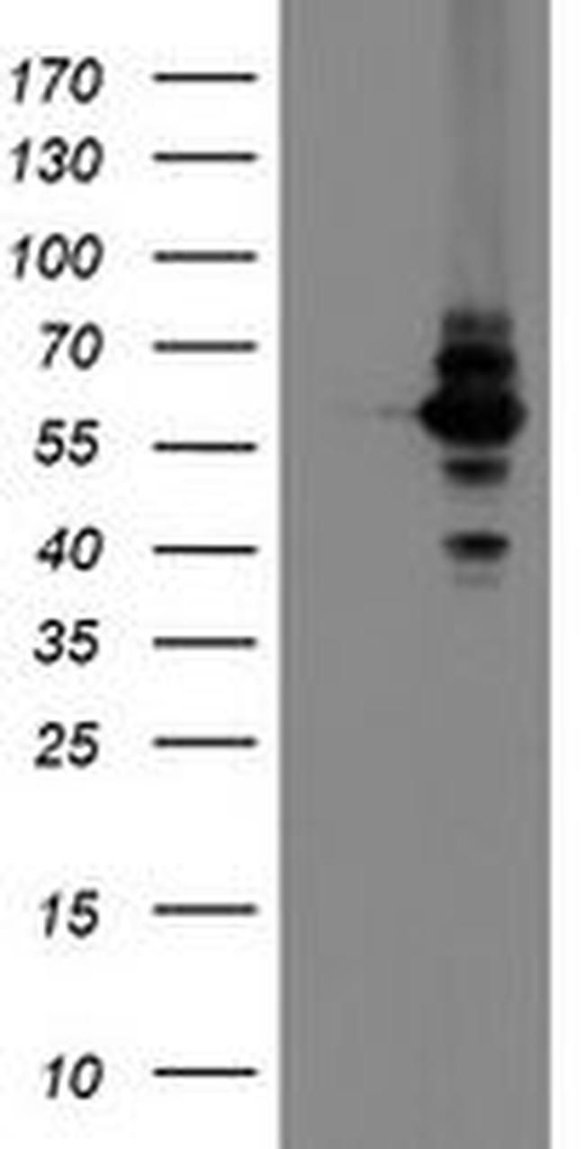 DPH2 Antibody in Western Blot (WB)