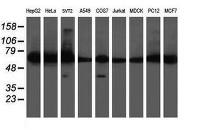 DPH2 Antibody in Western Blot (WB)