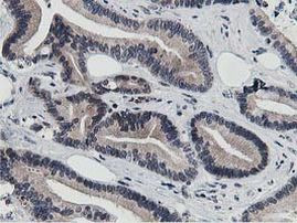 DPP3 Antibody in Immunohistochemistry (Paraffin) (IHC (P))