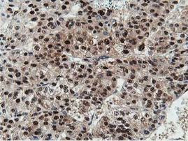 DPP3 Antibody in Immunohistochemistry (Paraffin) (IHC (P))