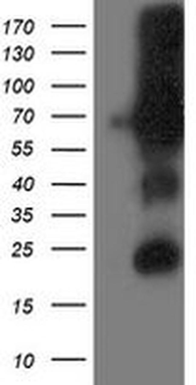 DPP3 Antibody in Western Blot (WB)