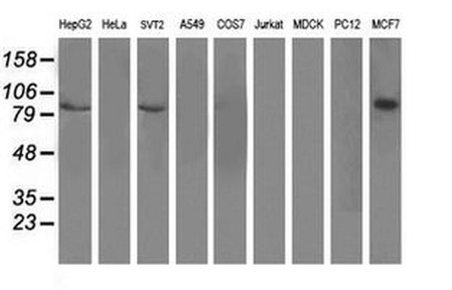 DPP3 Antibody in Western Blot (WB)