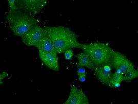 DPP4 Antibody in Immunocytochemistry (ICC/IF)