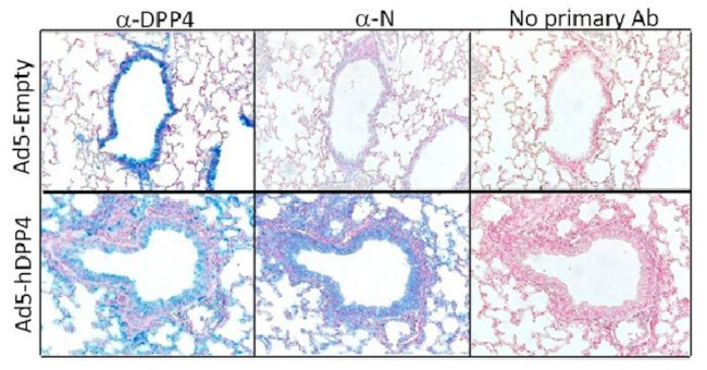 DPP4 Antibody in Immunohistochemistry (Paraffin) (IHC (P))