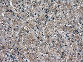 DPP4 Antibody in Immunohistochemistry (Paraffin) (IHC (P))