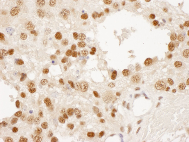 DPY30 Antibody in Immunohistochemistry (IHC)