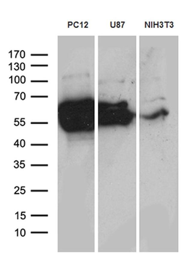 DPYSL2 Antibody in Western Blot (WB)