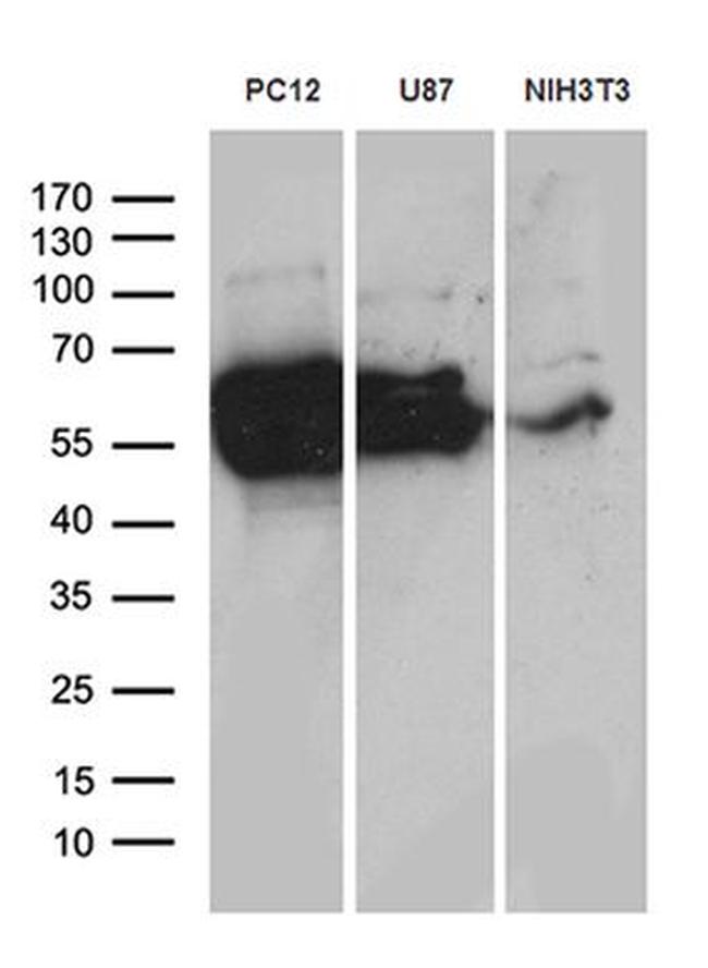 DPYSL2 Antibody in Western Blot (WB)