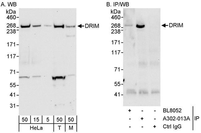 DRIM Antibody in Western Blot (WB)