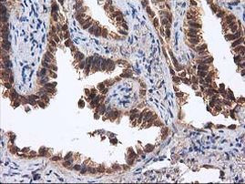 DSTN Antibody in Immunohistochemistry (Paraffin) (IHC (P))