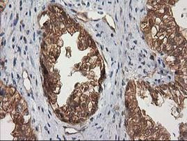 DSTN Antibody in Immunohistochemistry (Paraffin) (IHC (P))