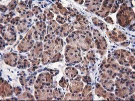 DSTN Antibody in Immunohistochemistry (Paraffin) (IHC (P))