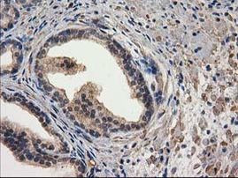 DSTN Antibody in Immunohistochemistry (Paraffin) (IHC (P))