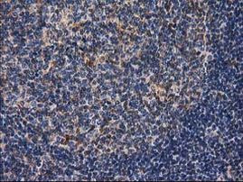 DSTN Antibody in Immunohistochemistry (Paraffin) (IHC (P))