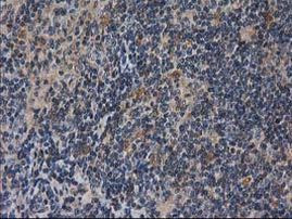 DSTN Antibody in Immunohistochemistry (Paraffin) (IHC (P))