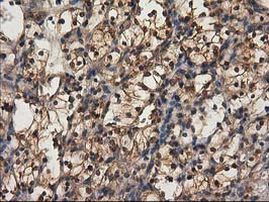 DSTN Antibody in Immunohistochemistry (Paraffin) (IHC (P))