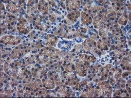 DSTN Antibody in Immunohistochemistry (Paraffin) (IHC (P))