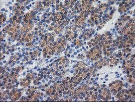 DSTN Antibody in Immunohistochemistry (Paraffin) (IHC (P))