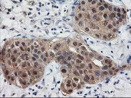 DSTN Antibody in Immunohistochemistry (Paraffin) (IHC (P))